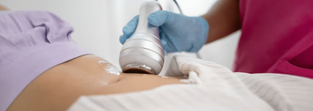 Cellulite Reduction