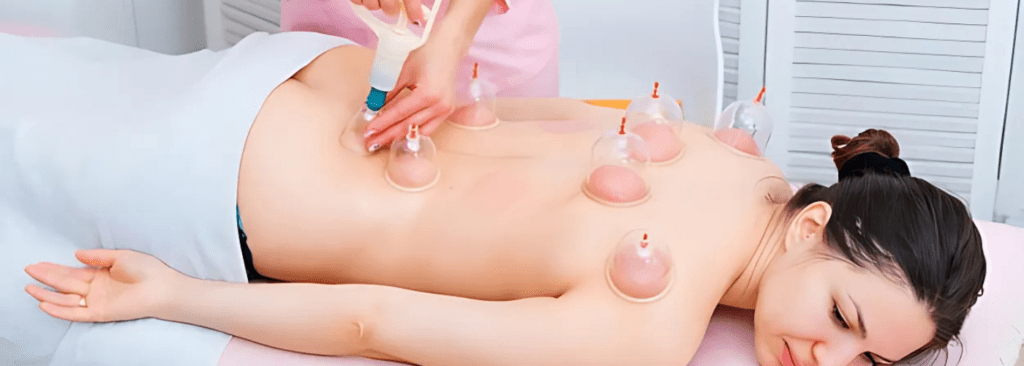 Cupping Therapy