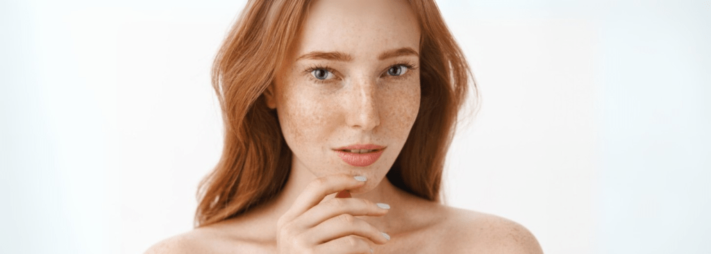 Freckles, Sunspots & Marks