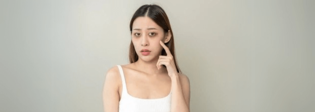 Under eye dark circles Hollowness Bags